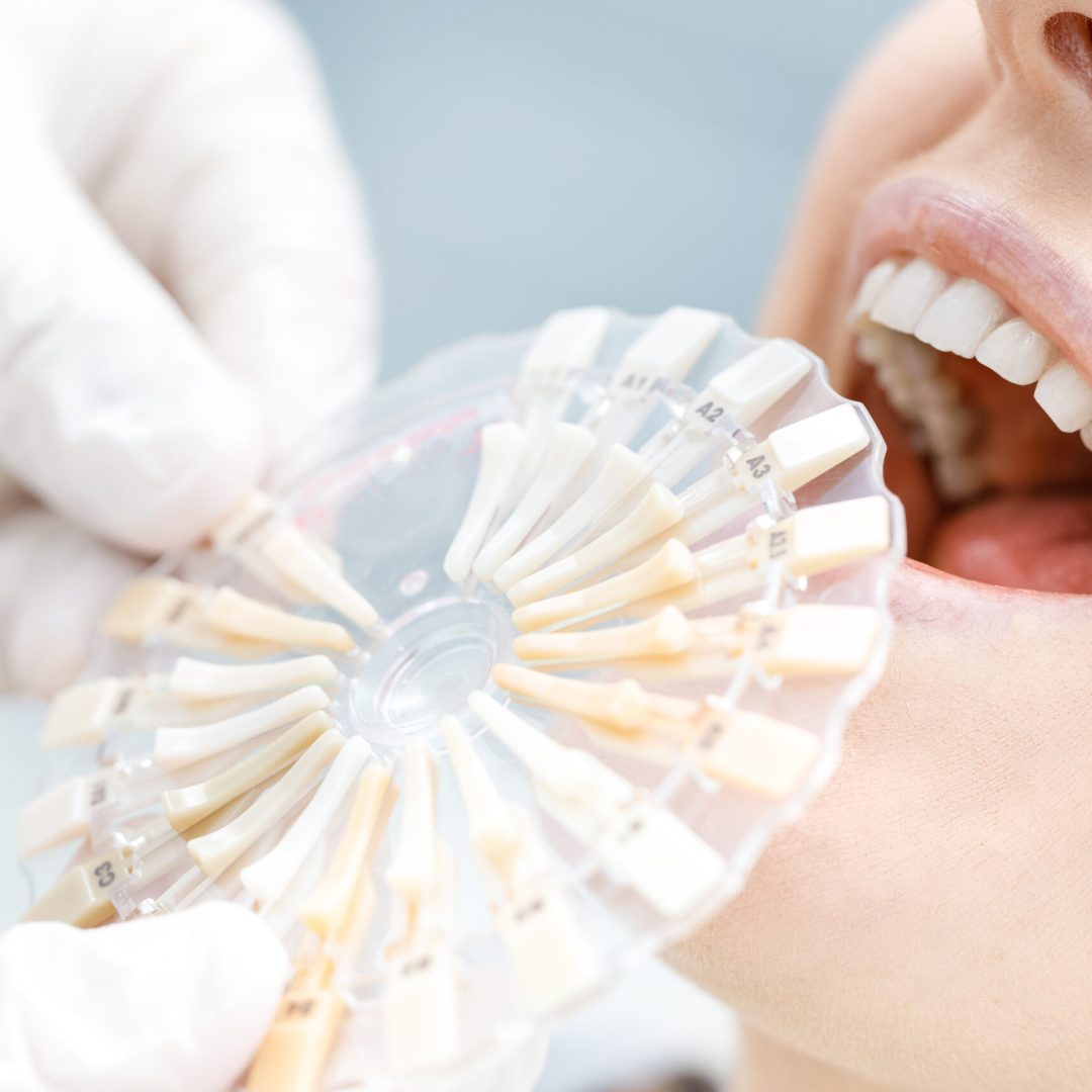 Close-up partial view of dentist comparing teeth of patient with samples
