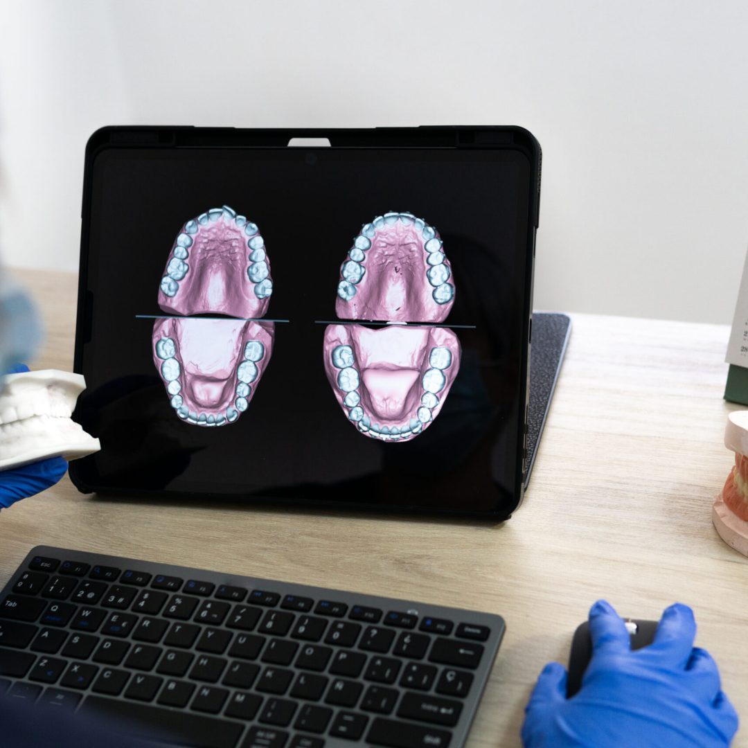 A dental technician designing a new dental prosthesis on the computer