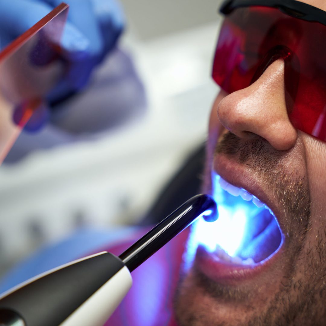 Cropped photo of man in glasses sitting in dental chair and having dental equipment in his open mouth